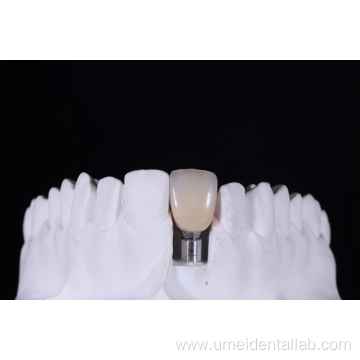 Zirconia Implant crown